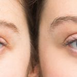 Strácate zrak? Na vine môže byť sivý zákal